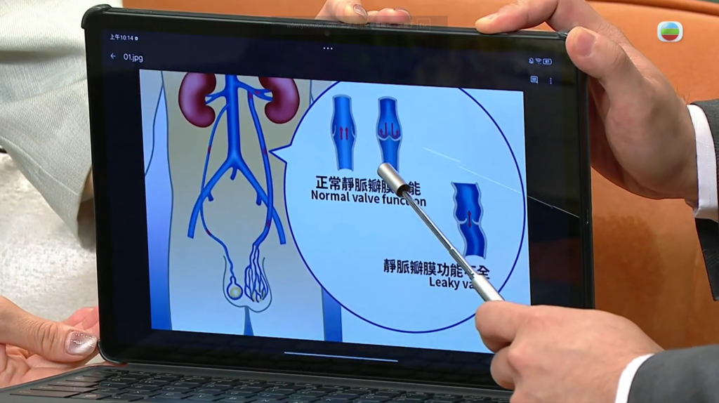黃家榮醫生於節目講解什麼是精索靜脈曲張